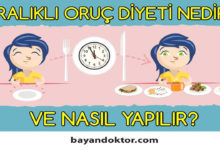 Aralıklı Oruç Diyeti Nedir? Nasıl Yapılır?