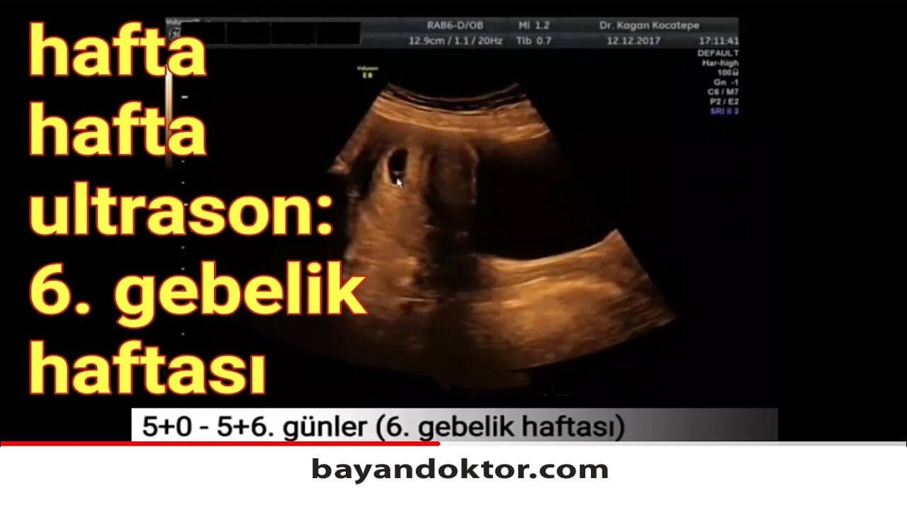 6. Hafta Gebelik – Hafta Hafta Hamilelik