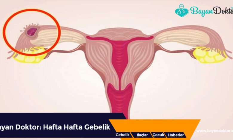 Ektopik Gebelik Nedir?