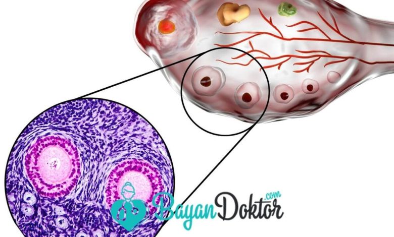 Korpus Luteum Nedir