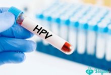 HPV