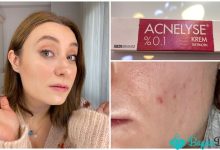 Acnelyse %0,1 Krem Nedir? Ne İşe Yarar?