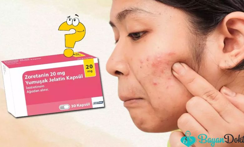 Zoretanin 20 MG 30 Kapsül Nedir? Ne İşe Yarar? 1 Zoretanin 20 MG 30 Kapsül Nedir? Ne İşe Yarar?